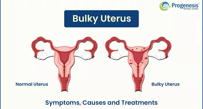 5 Possible Causes of Infertility Due to an Enlarged Uterus