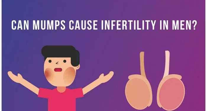 Mumps and Male Infertility: What the Connection and Risks