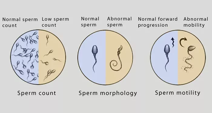 how do you know if your man is infertile