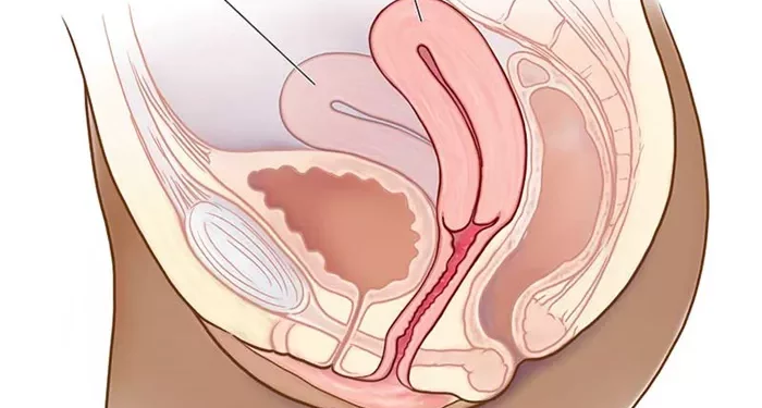 Tilted or Retroverted Uterus: does it really matter if you’re pregnant?