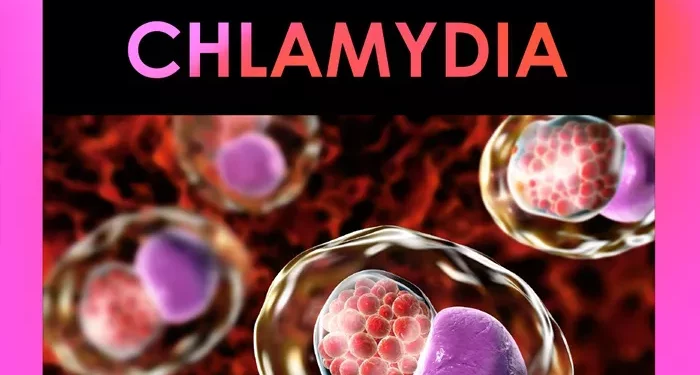 chlamydia
